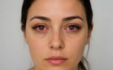 Avoiding red eye after Eyelash Extension Treatments