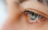What's the difference between Blepharitis and a true lash glue allergy or sensitivity?